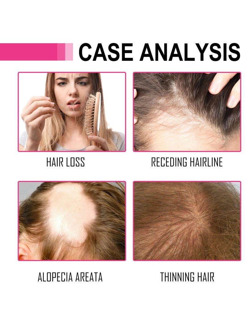 HOEGOA Moroccan Hair Essential Oil, Plant Extract Hair Oil, Extra Penetrating Oil, Dry And Coarse Hair Types, 70 ml - Image 5