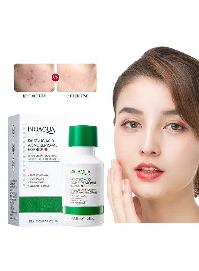 BIOAOUA Salicylic Acid Acne Removal Essence - Oily Skin | Helps Improve the Appearance of Enlarged Pores, Pimples, Blackheads and Uneven Texture, Moisturizing and shrinking Essence, 35 ml - Image 1
