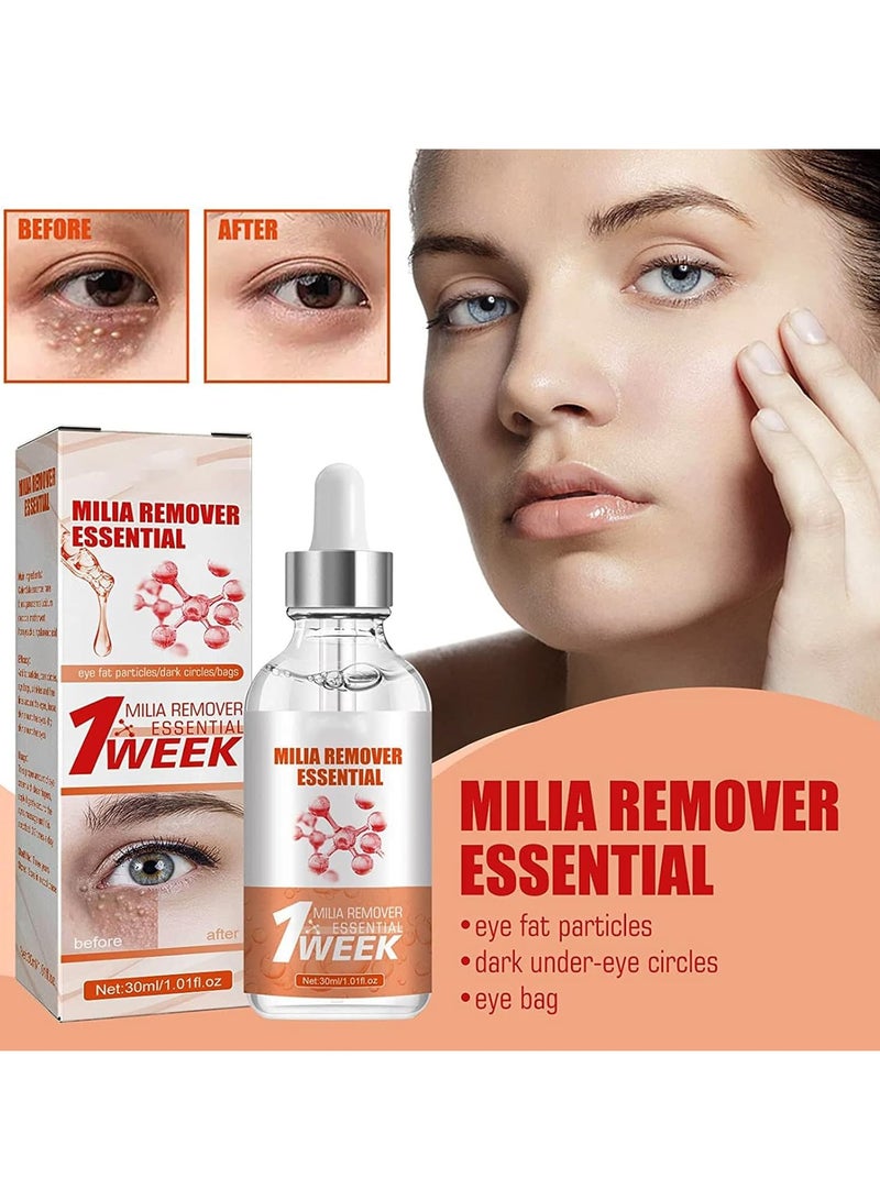 SOUTH MOON Fast Milia Remover, Milia Remover Essential, Fade Fine Lines, Fine Lines, Eye Spot Effect, Eye Lifting & Firming  - Image 2