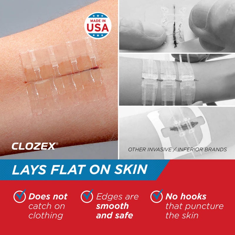 Clozex Complete Emergency Laceration Kit - Repair Wounds Without Stitches, FSA HSA Eligible Skin Clean Cover Closure Device for 2 Individual Or Combine for 2 1/2 in. Length - Image 4