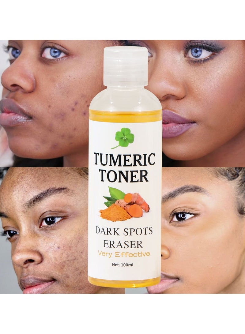 MOOYAM Tumeric Toner Dark Spots Eraser Correcting Toner, Facial Toner for Acne Prone Skin, Blemish Removing Facial Moisturizer for Women, Dry Oily Skin Hypermentation Treatment, 100ml - Image 1