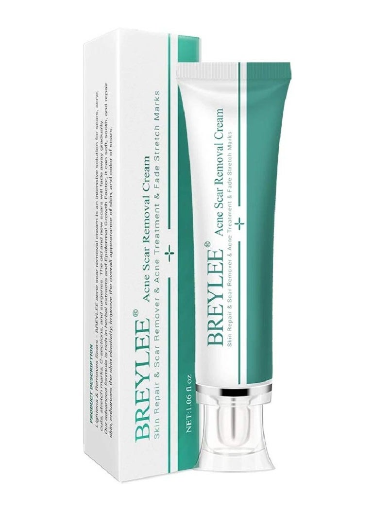 Breylee BREYLEE Acne Scar Removal Cream 30g Face Cream Skin Repair Skin Care Scar Acne Treatment Remove Stretch Marks Whitening Cream  - Image 1