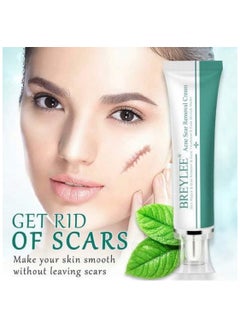 Breylee BREYLEE Acne Scar Removal Cream 30g Face Cream Skin Repair Skin Care Scar Acne Treatment Remove Stretch Marks Whitening Cream  - Image 5