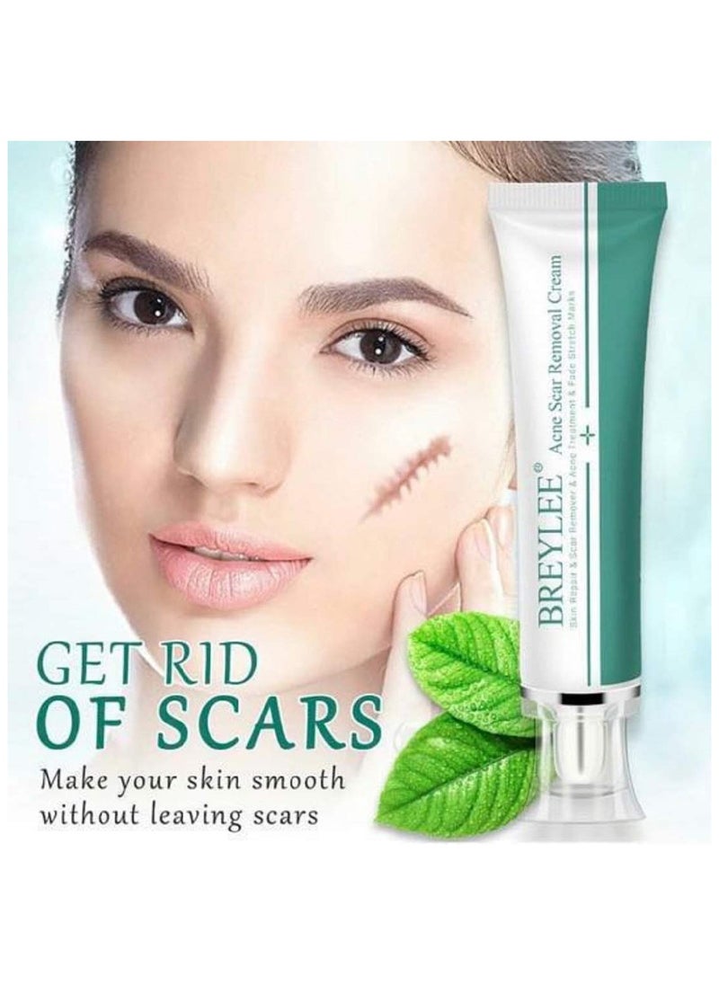 Breylee BREYLEE Acne Scar Removal Cream 30g Face Cream Skin Repair Skin Care Scar Acne Treatment Remove Stretch Marks Whitening Cream  - Image 5