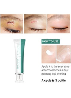 Breylee BREYLEE Acne Scar Removal Cream 30g Face Cream Skin Repair Skin Care Scar Acne Treatment Remove Stretch Marks Whitening Cream  - Image 3