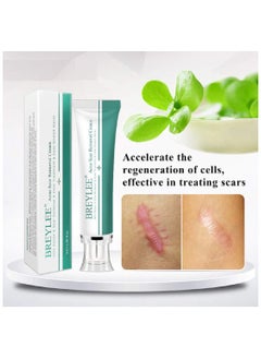 Breylee BREYLEE Acne Scar Removal Cream 30g Face Cream Skin Repair Skin Care Scar Acne Treatment Remove Stretch Marks Whitening Cream  - Image 2