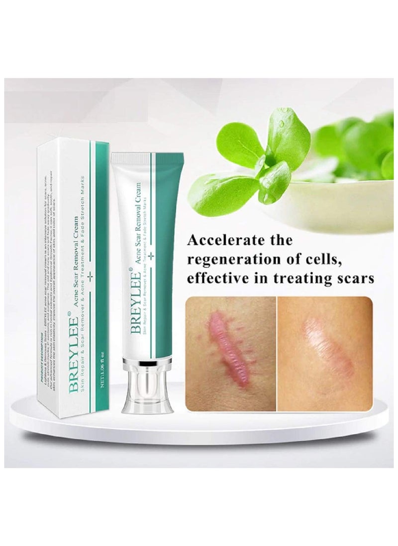 Breylee BREYLEE Acne Scar Removal Cream 30g Face Cream Skin Repair Skin Care Scar Acne Treatment Remove Stretch Marks Whitening Cream  - Image 2