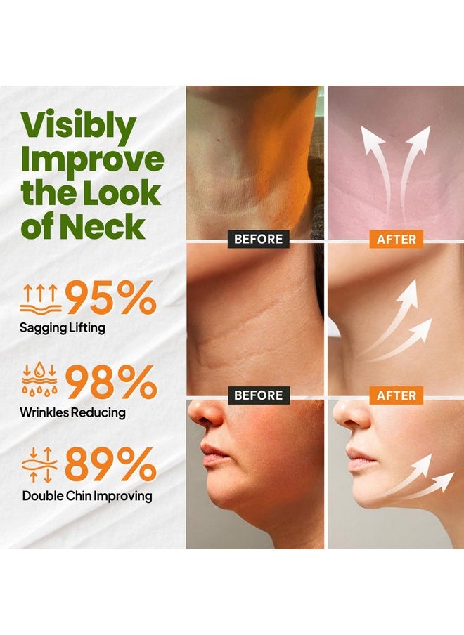 RONKIE - Neck Cream for Tightening Firming: Instant Face Lift Cream - Wrinkle Cream for Women- Anti Wrinkle Cream with Retinol Collagen & Hyaluronic Acid - Lifting, Firming & Hydrating - 1.7 FL OZ - Image 1