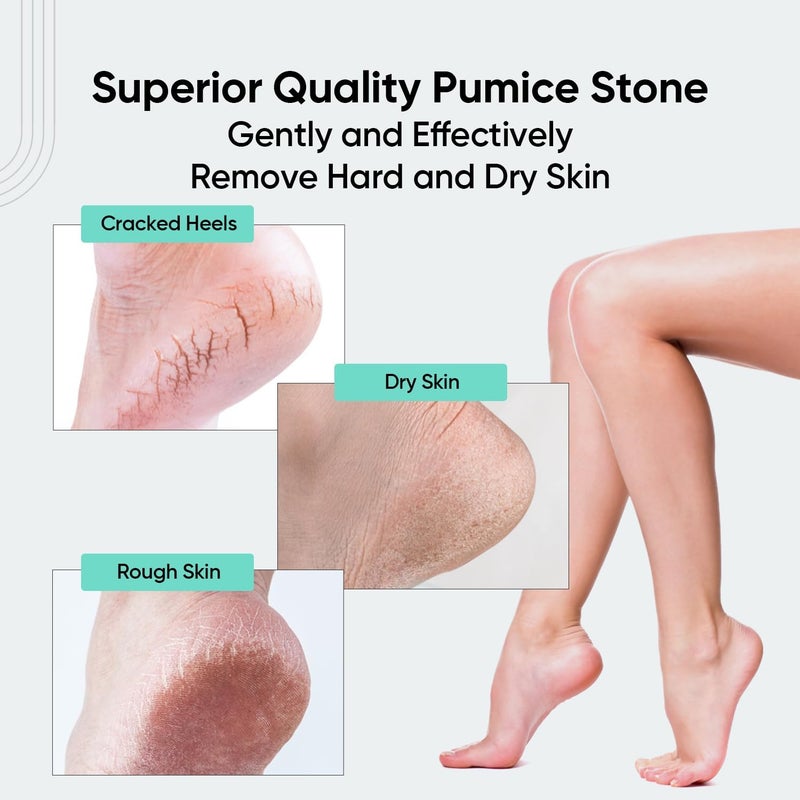 Vega Oval Shaped Pumice Stone, White - Image 3