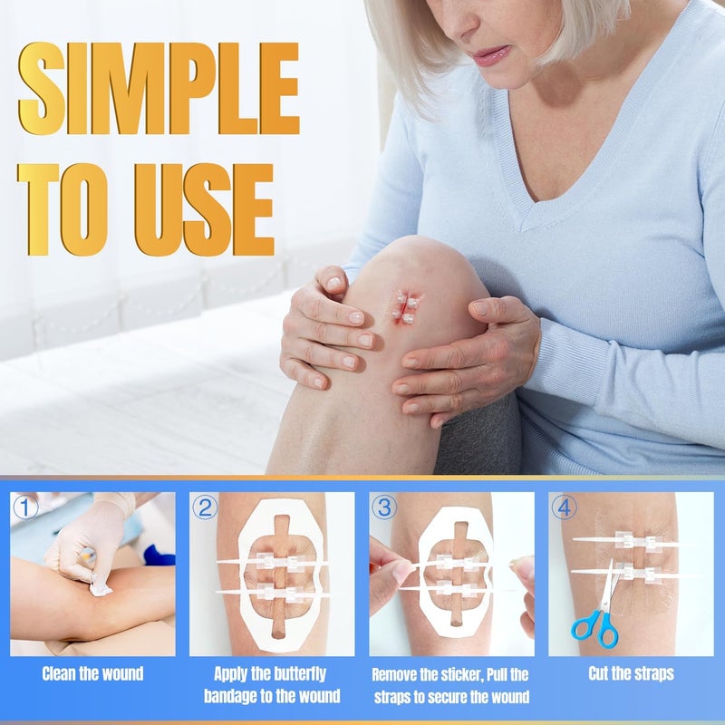 4 مجموعات من لاصقات الفراشة للعناية بالجروح جهاز إغلاق الجروح الطارئة إصلاح الجروح الجراحية بدون خياطة إغلاق سريع للجلد من الدرجة الطبية للاستخدام المنزلي في الهواء الطلق شرائط إغلاق الجروح بسحاب - Image 2