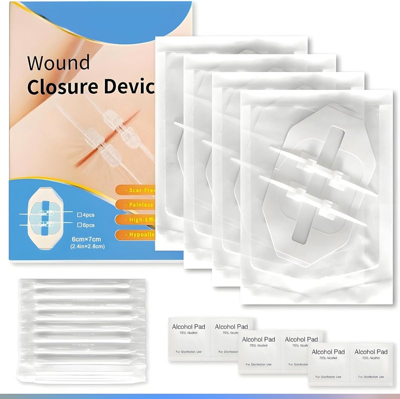 4 مجموعات من لاصقات الفراشة للعناية بالجروح جهاز إغلاق الجروح الطارئة إصلاح الجروح الجراحية بدون خياطة إغلاق سريع للجلد من الدرجة الطبية للاستخدام المنزلي في الهواء الطلق شرائط إغلاق الجروح بسحاب - Image 1