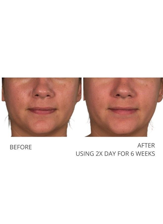 Serious Skincare - A Defiance Retinol Pads Vitamin A Daily Facial Treatment Presoaked Facial Disc Micro Exfoliate Dead Skin Cells Sugar Cane + Algae Extract 120 Pads (2Pack/60 Pads Each) - Image 1