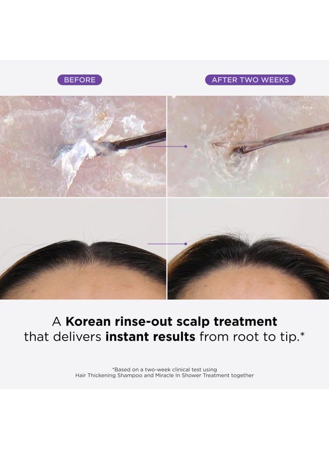 Dr.Groot Miracle in Shower Treatment for Hair Loss, Korean Hair Care, 5 Seconds to Smooth Hair, Rosemary Oil for Healthier-Looking Hair, Hair Rinse, Moisturizing Treatment,Scalp Revitalizing Solution - Image 2