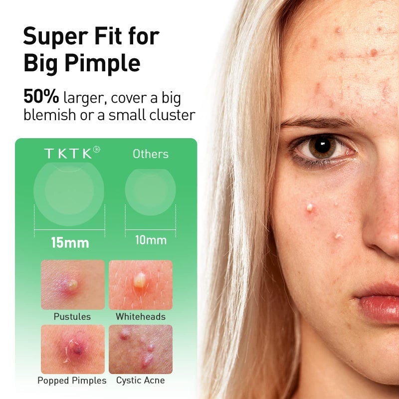 TKTK Pimple Patches, 15 mm Invisible Acne Patches for Face with Salicylic Acid, 0.01cm Extra Thin Outer Edge, Hydrocolloid Zit Patch for Pustule, Whitehead, Cystic Acne Spot, 96 Count - Image 3