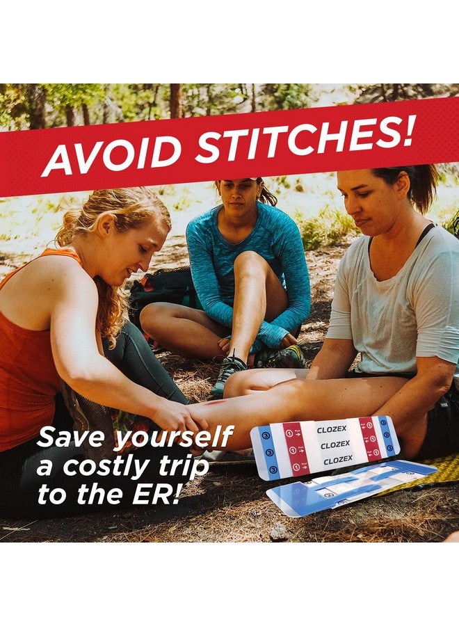 Clozex Emergency Laceration Closures - Repair Wounds Without Stitches. Fda Cleared Skin Closure Device For 3 Individual Wounds Or Combine For Total Length Of 4 1/4 Inches.  - Image 1