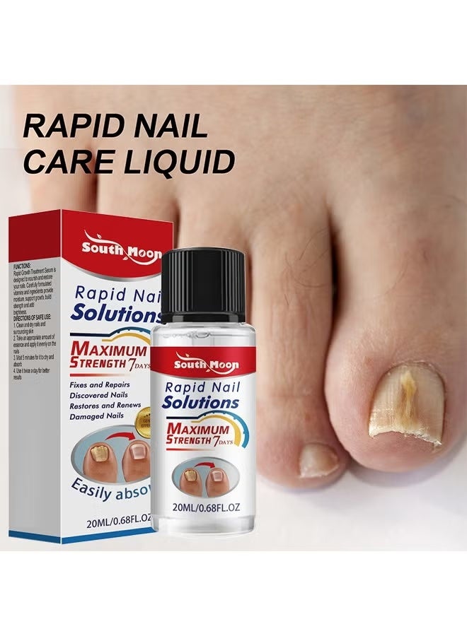 ساوث مون سائل العناية السريعة بالأظافر - علاج فطري للأظافر لأظافر أصابع القدم والأظافر للأظافر السميكة والمتغيرة اللون - يجدد أظافر القدم المتشققة التالفة - Image 2