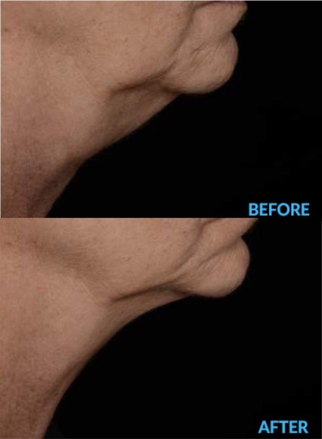 AminoGenesis N.E.C.K Control: Neck Lifting, Firming And Retracting Cream - Image 4
