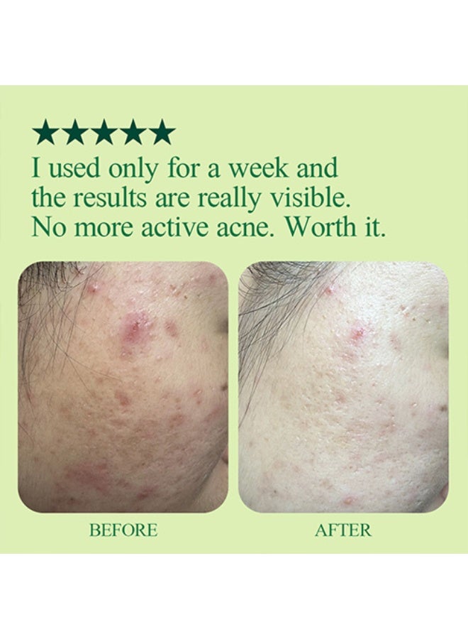 بيون كانج يول  [Pyunkang Yul] Ultimate Calming Solution Ampoule 30ml - Image 3