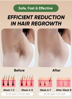 موهير جهاز إزالة الشعر بالليزر بالنبضات – MO-9080  - Image 5