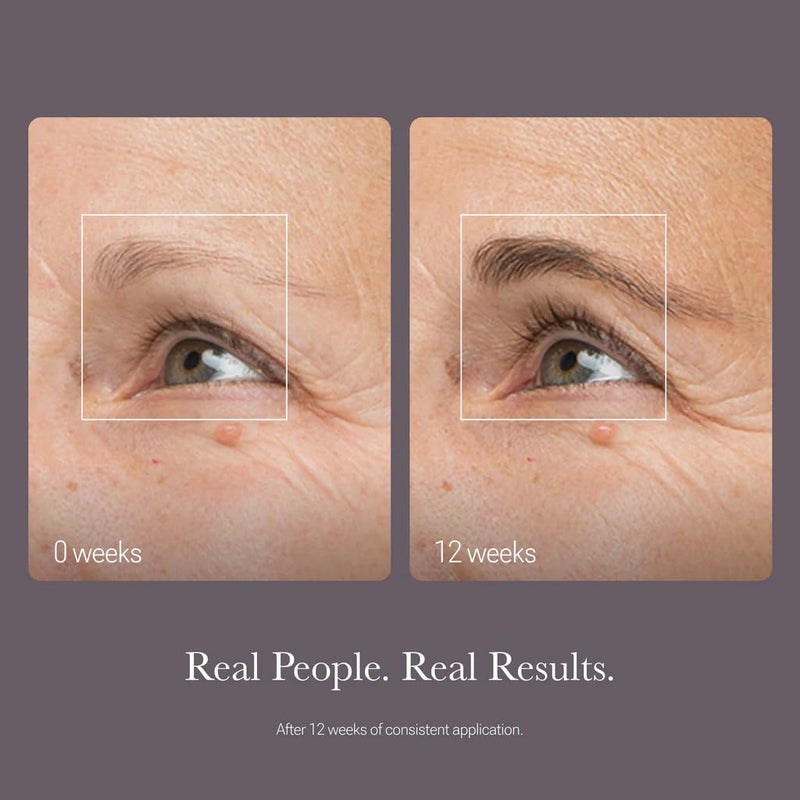 NULASTIN NULASTIN BROW Renewing Serum with Elastaplex, Eyebrow Enhancing Treatment for Thicker Looking Brows, Cruelty-Free (2-pack, 3 ml Each)  - Image 3