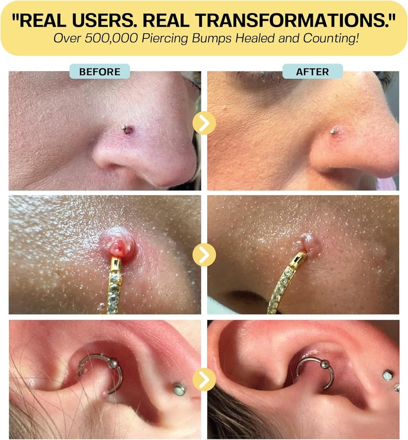 BASE LABORATORIES Piercing Bump & Keloid Bump Removal Solution | Soothing Piercing Aftercare | Bump Keloid Scar Removal | Ear & Nose Piercing Cleaner for Keloid Bumps | Piercing Aftercare Oil | 3PK - Image 4