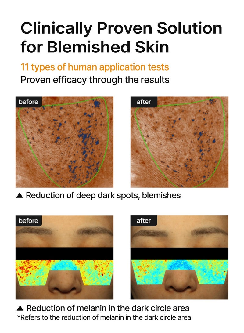 سيليماكس كريم لتفتيح المسام والبقع الداكنة | مع النياسيناميد وحمض الترانيكساميك وكريم تي اكس ايه لتقليل المسام ولا يسبب التهيج والترطيب للبشرة الحساسة، 35 مل - Image 5