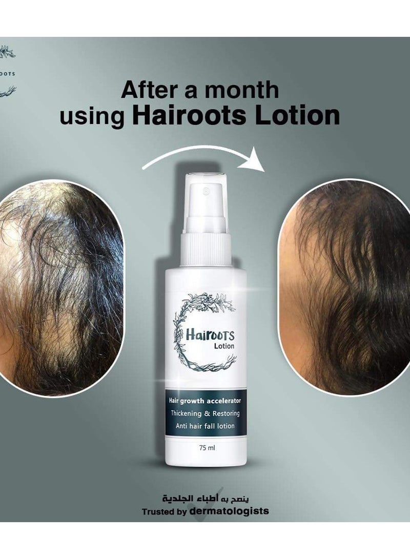 Hairoots Lotion Hair Growth Accelerator 75Ml