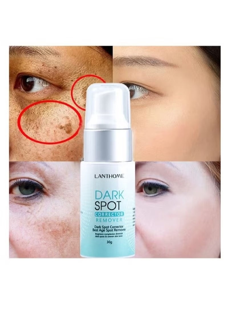 Lanthome Dark Spot Remover for Face Hyperpigmentation Treatment Dark Spots, Melasma, Freckle, Sun Spots Removal Dark Spot Corrector Cream for Women and Men 30g - Image 2