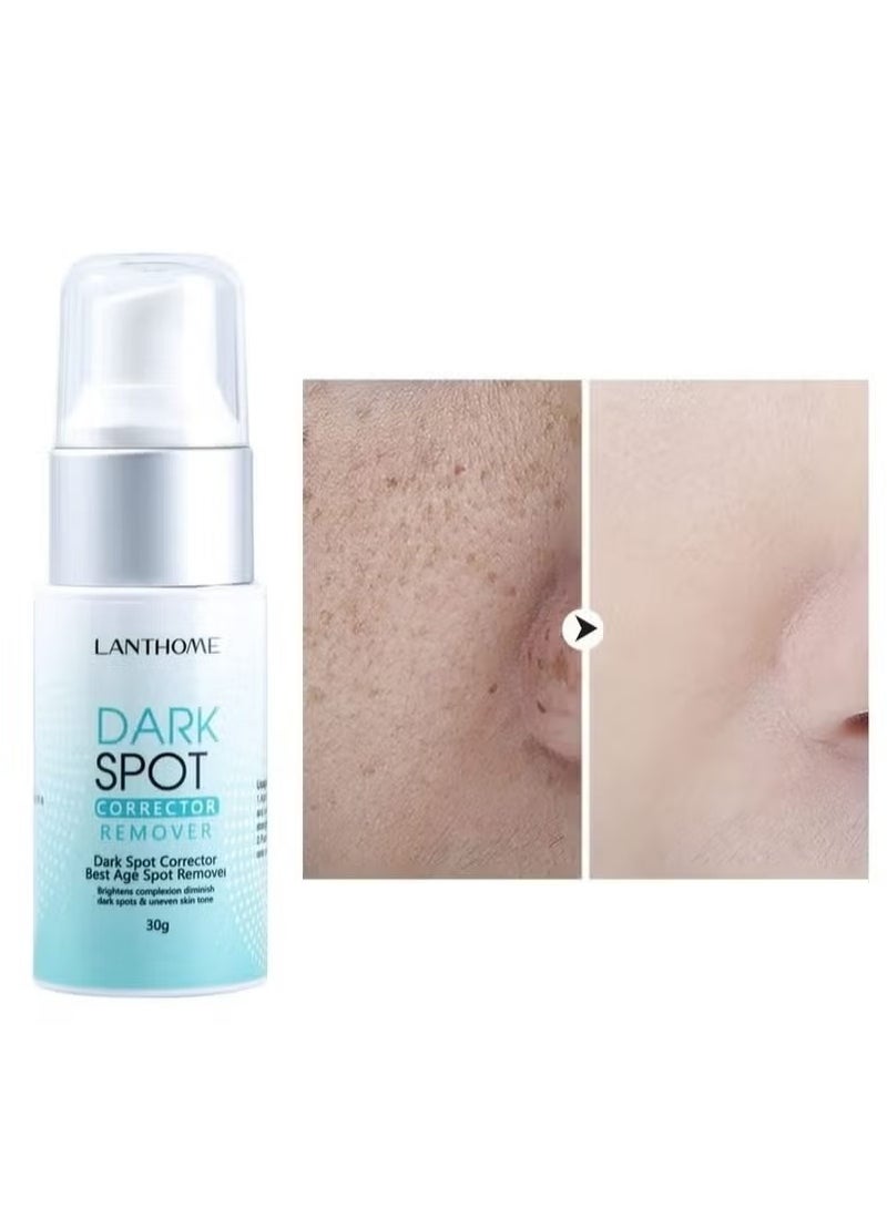 Lanthome Dark Spot Remover for Face Hyperpigmentation Treatment Dark Spots, Melasma, Freckle, Sun Spots Removal Dark Spot Corrector Cream for Women and Men 30g - Image 3