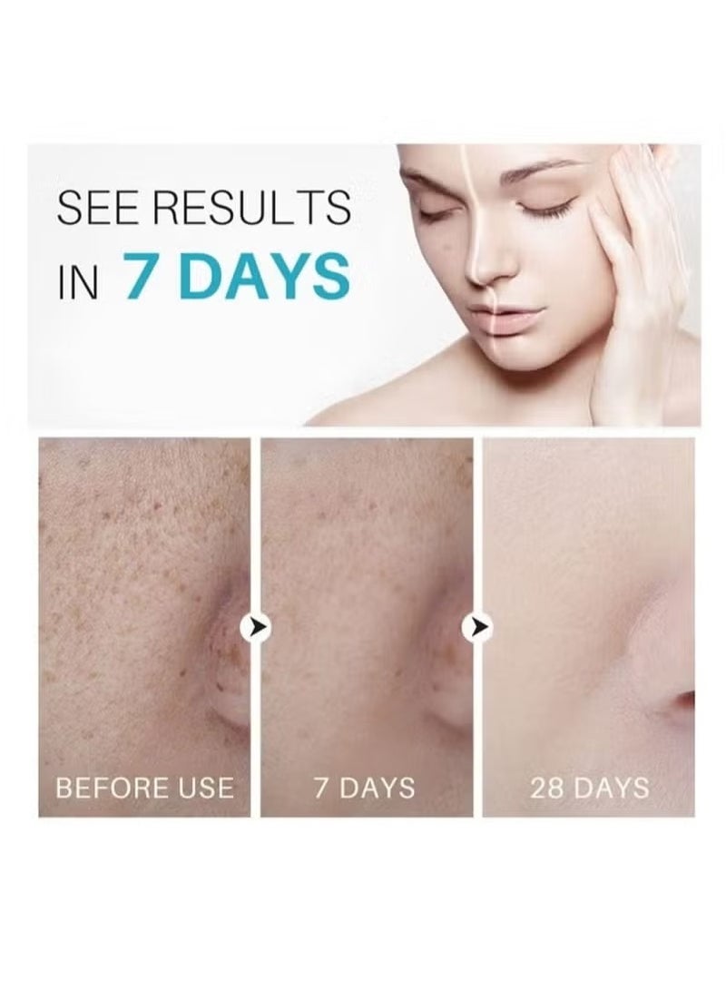 Lanthome Dark Spot Remover for Face Hyperpigmentation Treatment Dark Spots, Melasma, Freckle, Sun Spots Removal Dark Spot Corrector Cream for Women and Men 30g - Image 4