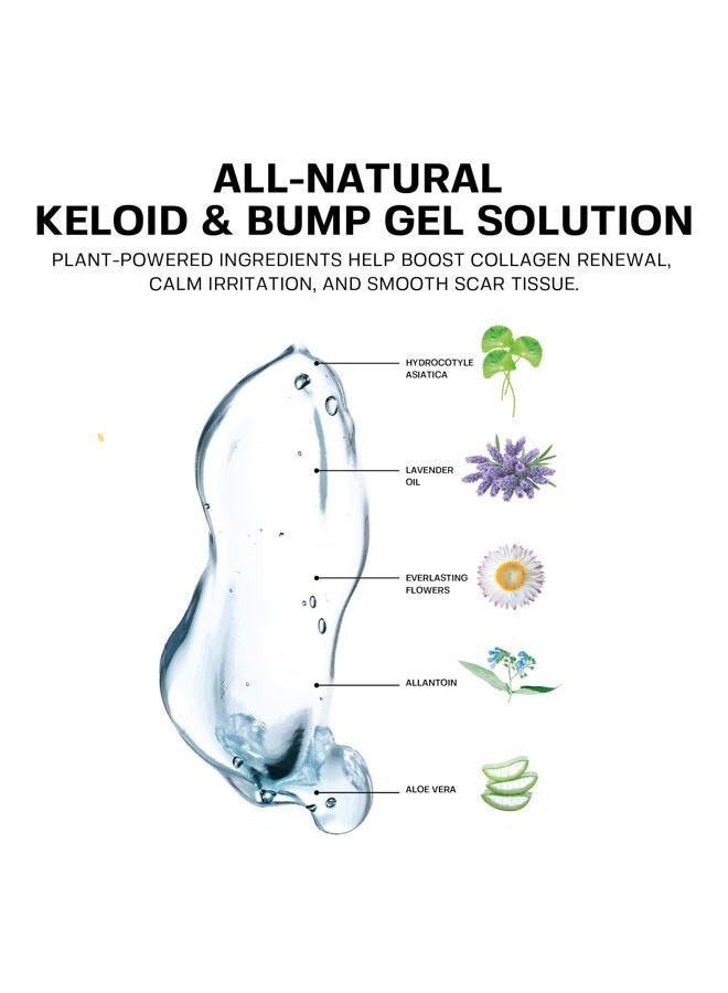 BASE LABORATORIES Keloid Bump Removal Gel | Natural Piercing Bump Treatment & Keloid Scar Gel | Keloid Scar Removal for all Scars, Keloids & Piercing Bumps | Soothing Piercing Aftercare | 2 oz - Image 2