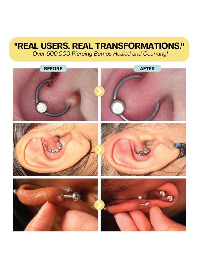 BASE LABORATORIES Keloid Bump Removal Gel | Natural Piercing Bump Treatment & Keloid Scar Gel | Keloid Scar Removal for all Scars, Keloids & Piercing Bumps | Soothing Piercing Aftercare | 2 oz - Image 5