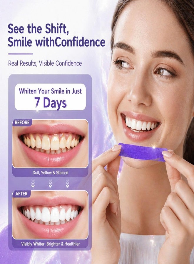 FENNIDICE Teeth Cleaning Patches for Daily Dental Care, Purple Tooth Strips with Colour Correction, Gentle Brightening, Gum Care & Stain Removal, Suitable for Sensitive Teeth—C - Image 5