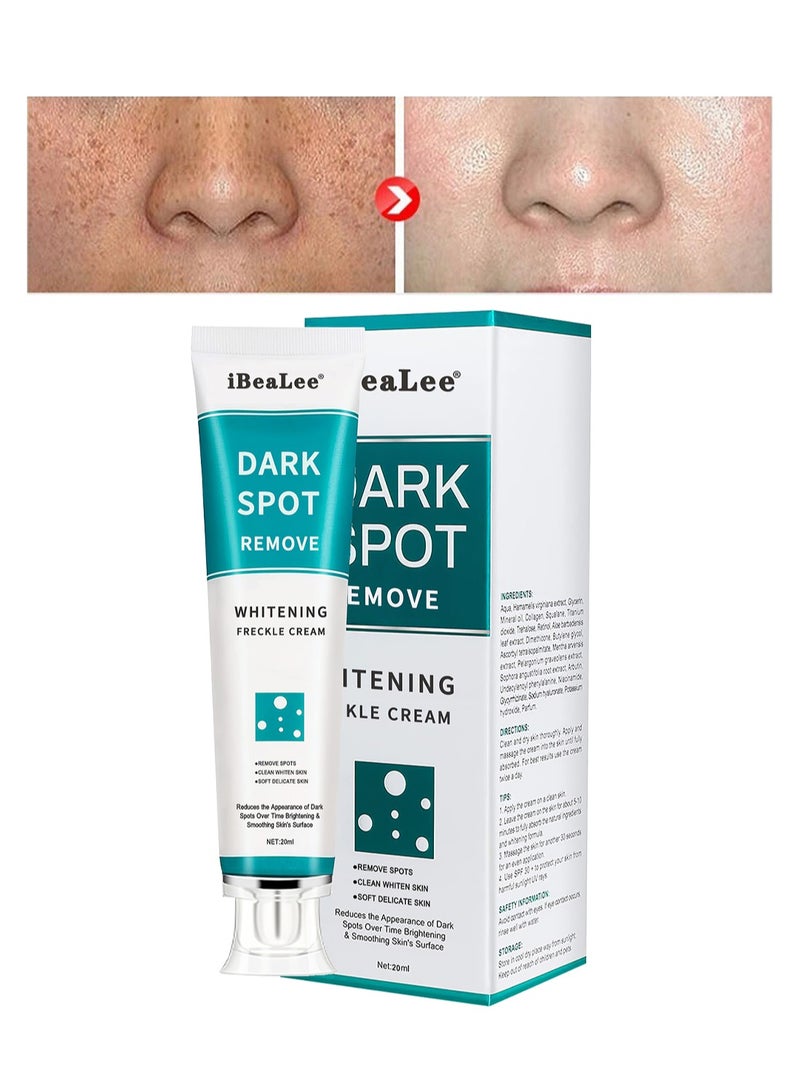 iBealee Dark Spot Remove, Mild Whitening Freckle Facial Cream, Pigmentation Sun Spots and Age Spots Treatment, Blemish Remover Lightening Cream, 20g  - Image 1