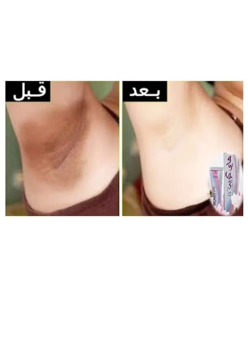 جمجوم فارما مجموعة العناية بالبشرة كريم أكريتين بتركيبة حمض التريتينوين بنسبة 0.025% 30 جرام لعلاج حب الشباب 30 جم + هاي كوين 4% كريم برو للتبييض وتفتيح البشرة المعزز والتقشير وعلاج حب الشباب 30 رجام - Image 4