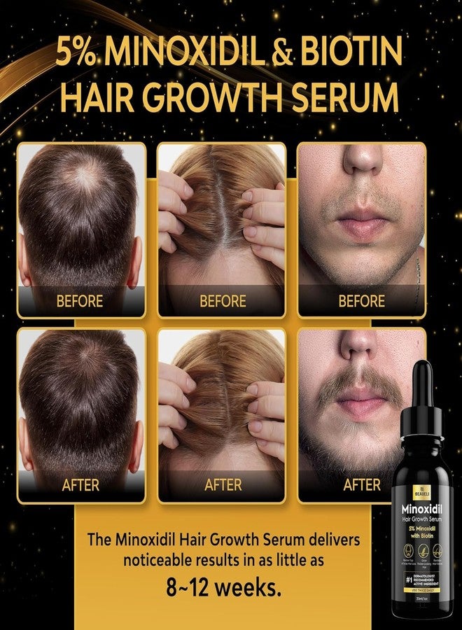 beaueli 5% Minoxidil Hair Growth for Men and Women: Extra Strength Minoxidil Beard Regrowth Treatment Serum with Biotin for Thinning Hair Loss to Grow Thicker Fuller 30ml 6 Bottles - Image 2