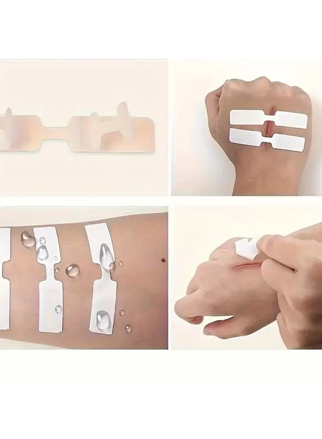 50 ضمادة سريعة الخياطة مقاس 10 سم لحماية الجروح بسلاسة - Image 1