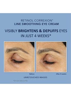 RoC Retinol Correxion Value Set Duo, Deep Wrinkle Anti-Aging Night Face Cream + Daily Under Eye Cream for Dark Circles & Puffiness, Moisturizer  - Image 2