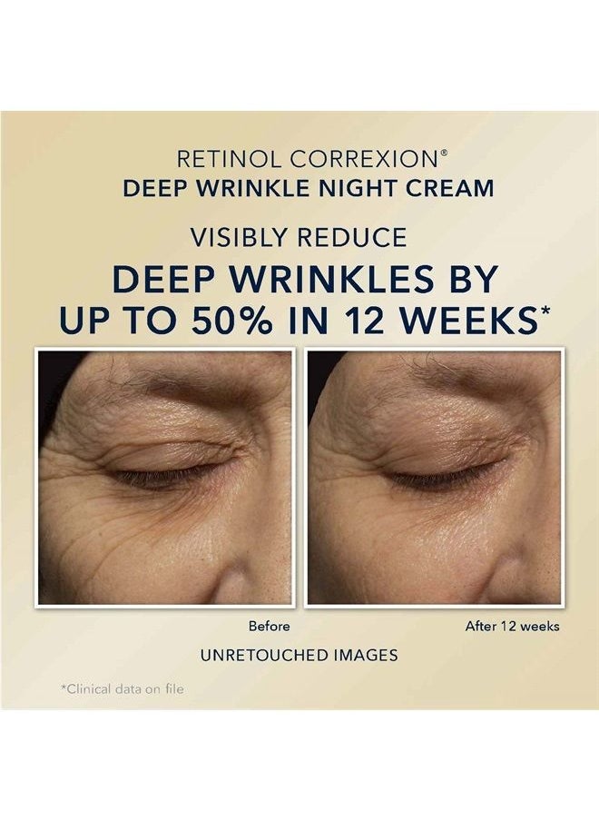 RoC - Retinol Correxion Value Set Duo, Deep Wrinkle Anti-Aging Night Face Cream + Daily Under Eye Cream for Dark Circles & Puffiness, Moisturizer - Image 1