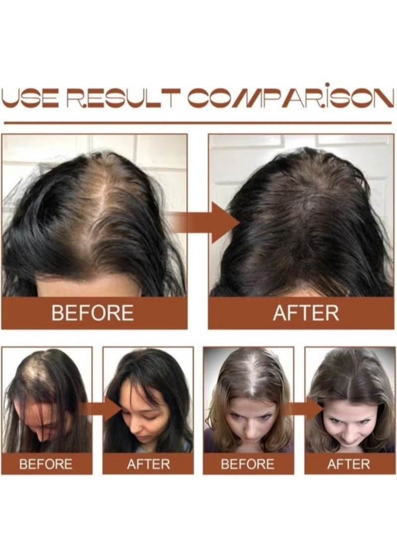 EELHOE Batana Oil for Hair Growth Healthier Thicker Fuller Hair, Batana oil, Batana Oil for Hair Growth, Batana Oil Organic, Batana Oil Organic for Healthy Hair, Batana Oil Hair Mask  - Image 4