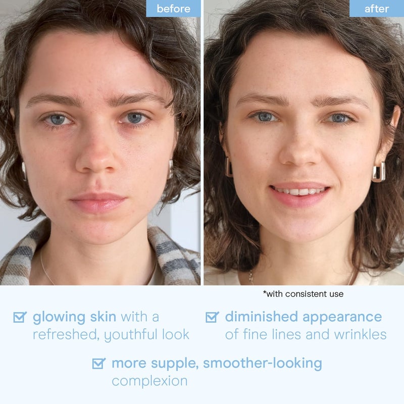 Baebody Snail Mucin Face Sheet Mask (6 pcs) - Anti Aging and Moisturizing Face Mask with Hyaluronic Acid - Deep Hydration for Youthful Skin - Image 5