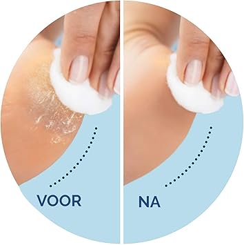 Scholl Velvet Smooth Dry Skin Roller Box of 2 Rolls - Image 2