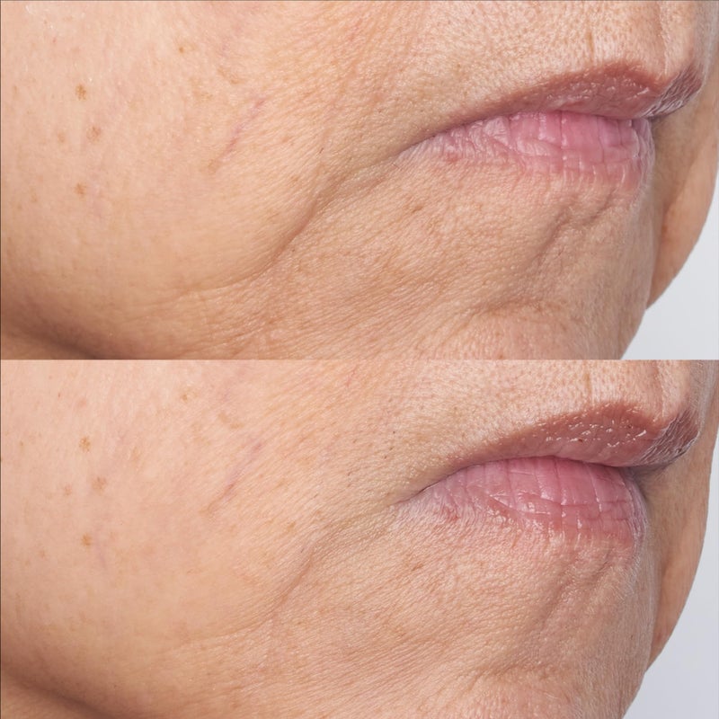 Perricone MD Cold Plasma Plus+ The Intensive Gel Mask, 2 fl. oz. - Image 3