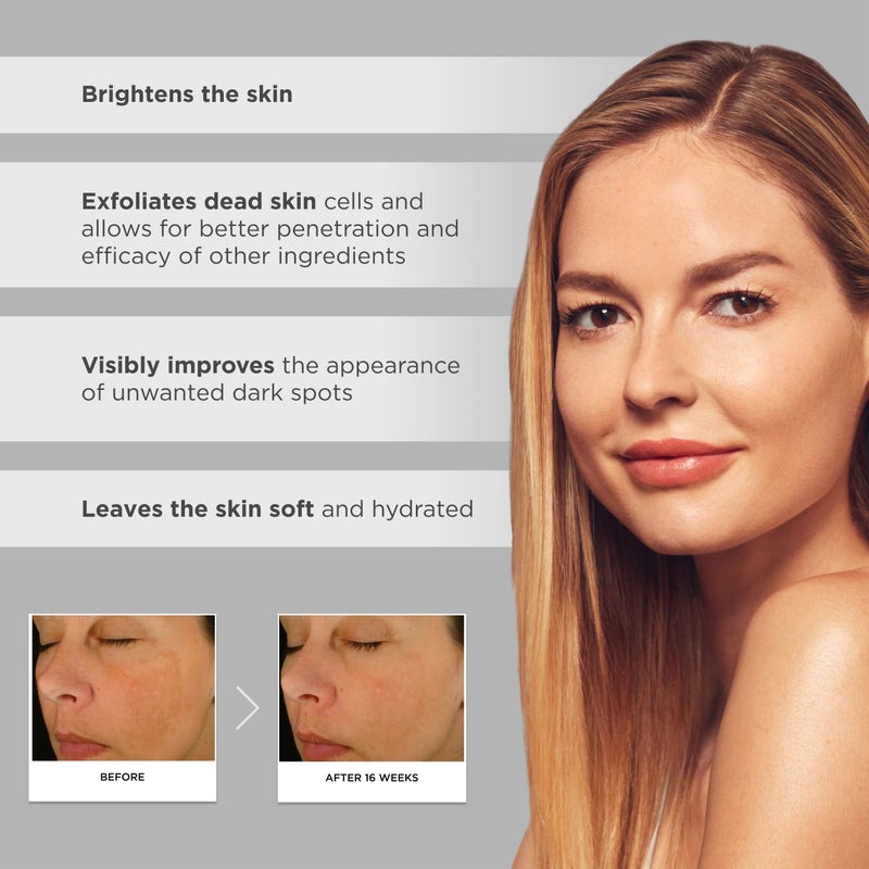 Glytone Enhance Brightening Complex - With 12% Azelaic Acid, 3% Glycolic Acid - Brightens Skin & Reduces Dark Spots - Non-Comedogenic - 1 fl. oz. - Image 5