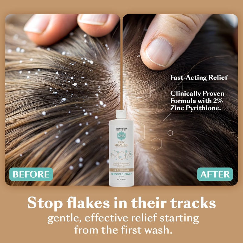 DHS Zinc Shampoo â€“ Dandruff Shampoo â€“ for Flaky and Dry Scalp with 2% Zinc Pyrithione, 16 oz - Image 3