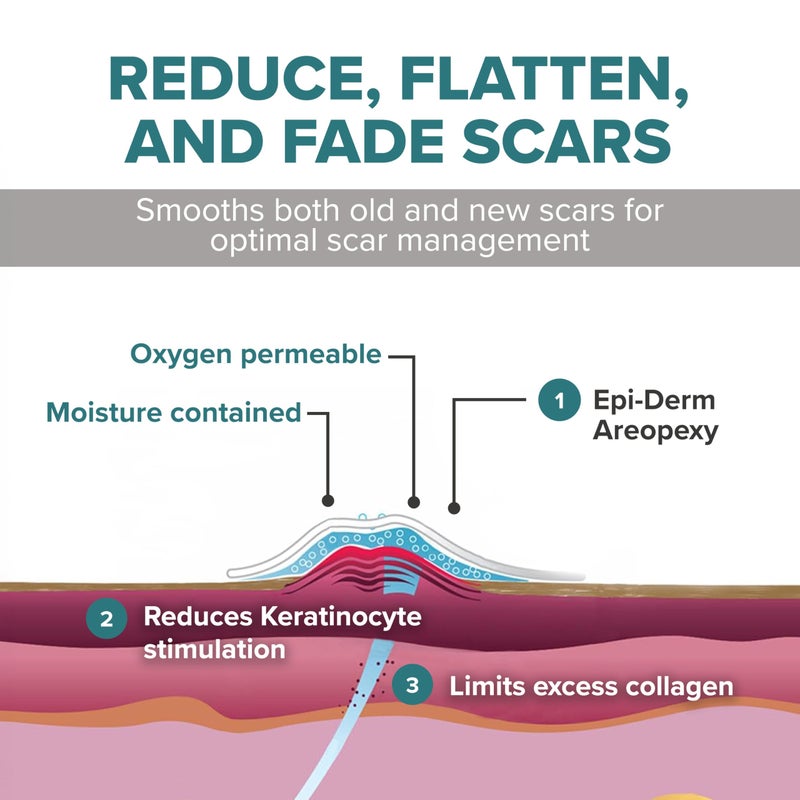 EPIDERMA أوراق السيليكون لعلاج الندبات من إبي-ديرم، أساسية بعد جراحة تقليل الثدي وزيادة الثدي، لاصقات ندبات احترافية بتصميم مصاصة، قابلة للقص، زوج - 1 زوج، طبيعي - Image 4