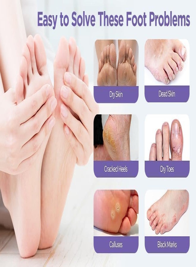 Hakily Foot Peeling Mask (1 Pair), Korean Peeling & Exfoliating | Deep Exfoliation with Glycolic Acid, Removes Dead Skin, Cruelty-Free, Foot Peel Off Mask (1 Pair Goat Milk Foot Mask) (2 Pair Goat Milk Foot Mask) - Image 4