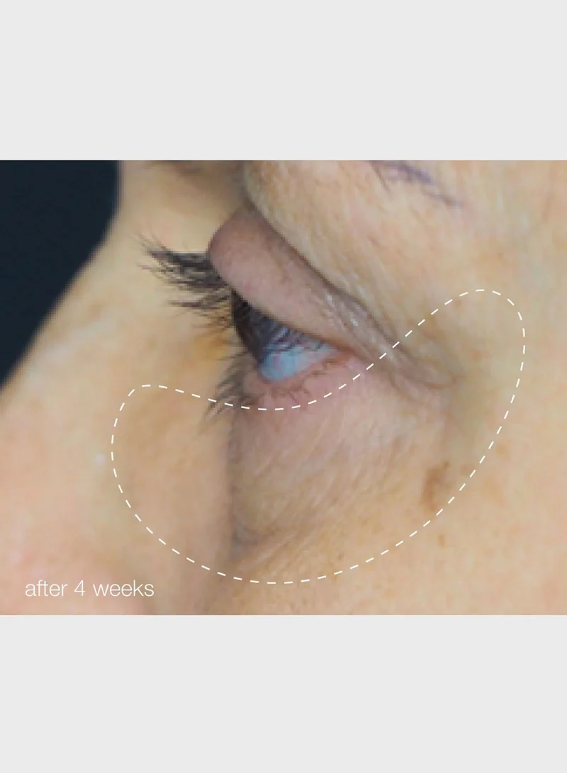 Dermalogica Awaken Peptide Eye Gel