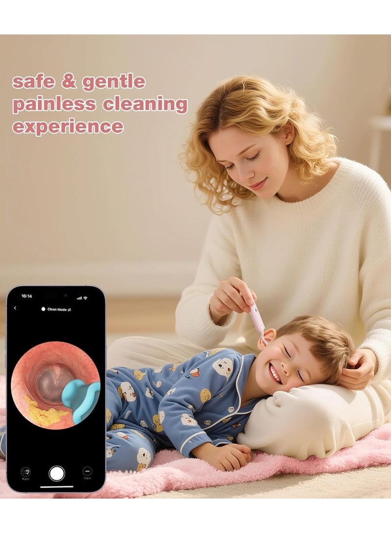 بيبيرد أداة إزالة شمع الأذن Earsight Plus I35R المزودة بكاميرا | منظف أذن ذكي مزود بملقط لطيف و12 طرفًا، منظار أذن عالي الدقة للبالغين والأطفال - Image 3