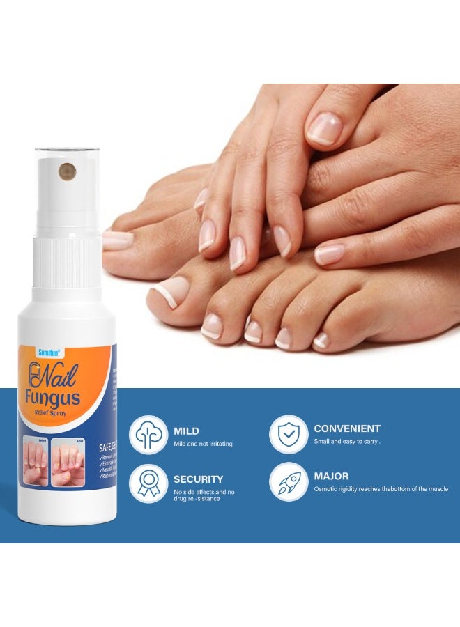 سوميفون رذاذ الإغاثة الفطرية للأظافر,إزالة الأظافر غير الصحية,استعادة واسترداد الأظافر الصحية 30ML - Image 3